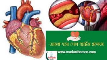 হার্টে ব্লকেজ ভাল হয়ে গেল