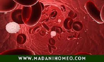 ব্লাড ক্যান্সারের সব লক্ষন থেকে মুক্তি