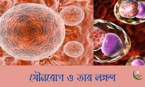 যৌনরোগ ও তার লক্ষণ