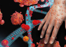 Monkeypox virus! Concerns