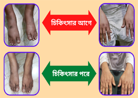 শরীরে পানি আসা ভাল হলো