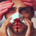 Causes of nosebleeds and what to do (1)