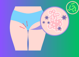 Syphilis symptoms and diagnosis