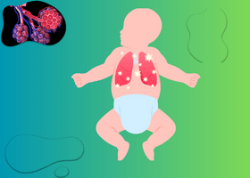 bronchiolitis-in-children-symptoms-treatment-and-prevention (1)
