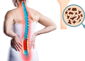 অস্টিওমাইলাইটিস (Osteomyelitis)