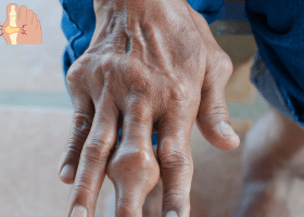 গাউট ,Gout (1)