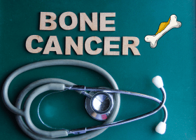 বোন ক্যান্সার, হাড়ের ক্যান্সার (1)