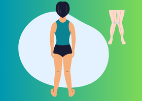 রিকেটস Rickets (1)