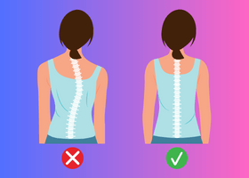 স্কলিওসিস-scoliosis-কি (1)