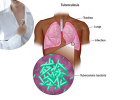 tuberculosis-and-mycobacteria-a-brief-introduction (1)