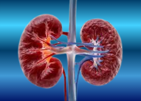 hydronephrosis-pid-pvr-case-study